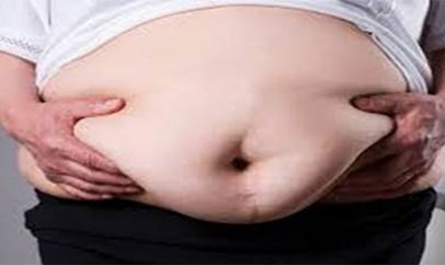 Obesity and Mental Health in South Florida: Understanding the Connection in Parkland and D...